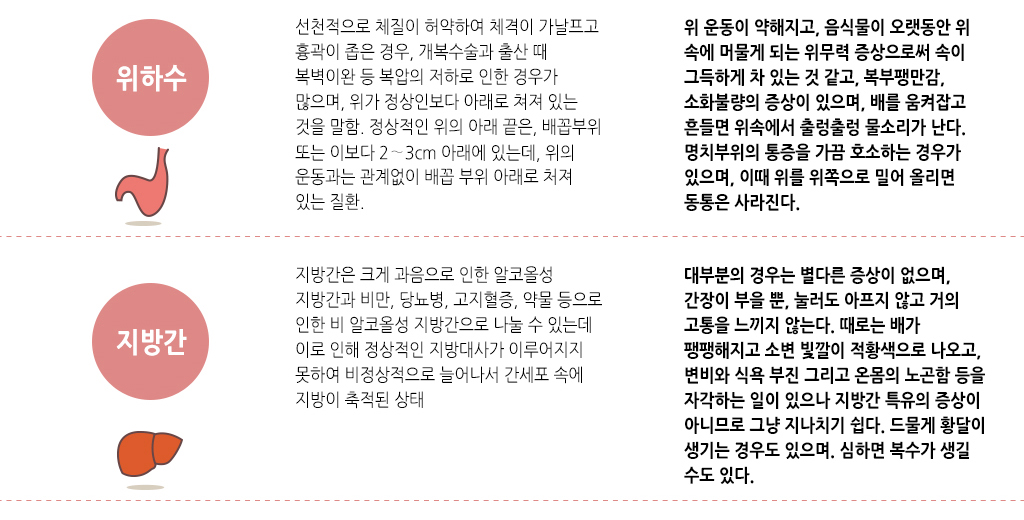한국한의원, 한국한의원 소화기 클리닉, 치료범위, 위하수, 지방간